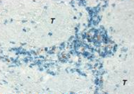 Murine monoclonal antibodies target human dendritic cells