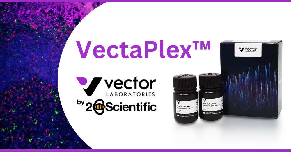 Have you tried the VectaPlex™ Antibody Removal Kit?