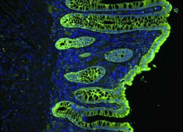 Tips-and-tricks-secondary-antibody