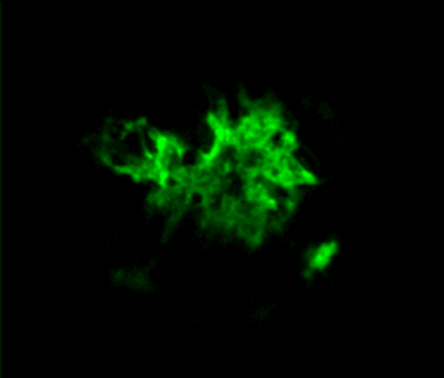 Amyloid Beta Products