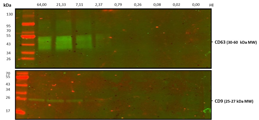 Western blot (WB)