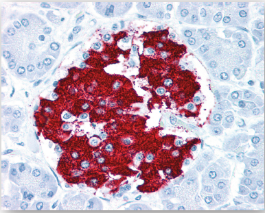 PathPlus™ Cancer Vimentin Antibody LS-B16168