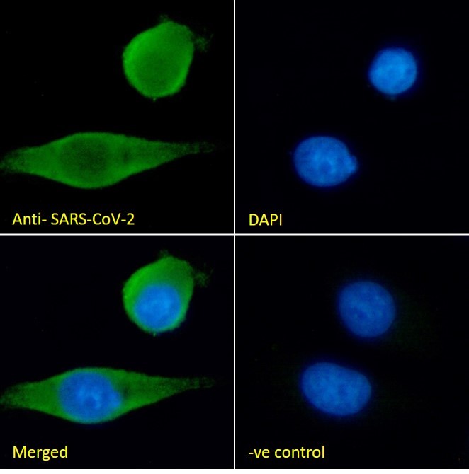 Discount on new SARS-CoV-2 Range from Absolute Biotech